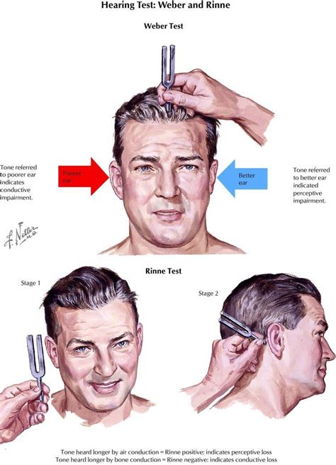 weber test nursing.